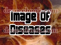 Image of diseases